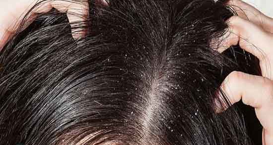 هلیله سیاه برای ریزش مو و خاصیت هلیله سیاه برای ریزش موی سر هلیله سیاه برای ریزش مو ؛ خاصیت هلیله سیاه برای ریزش موی سر